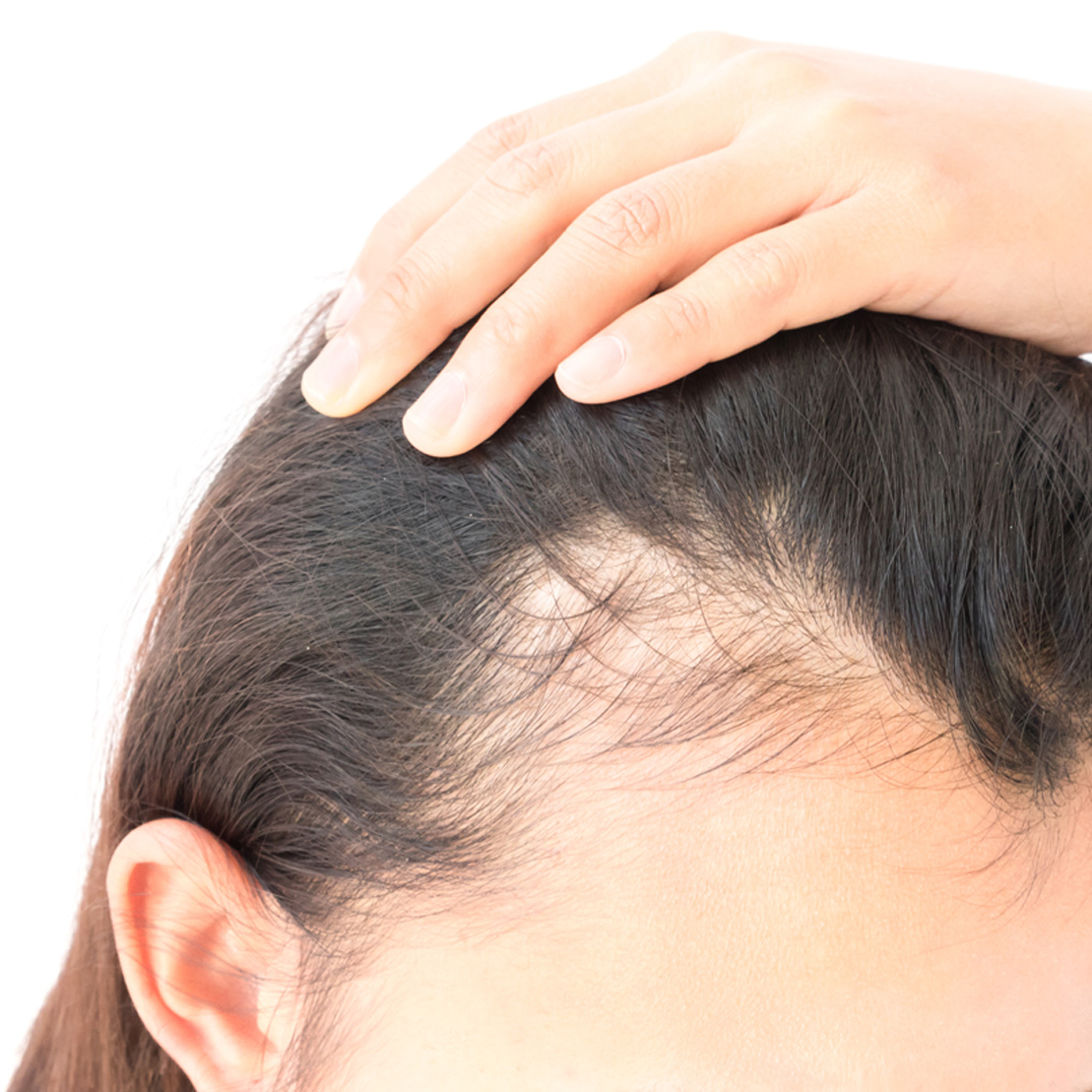Истончение и выпадение волос