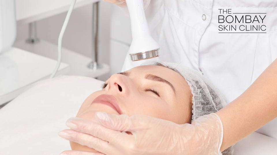 Skin Tightening Treatment, Laser Skin tightening